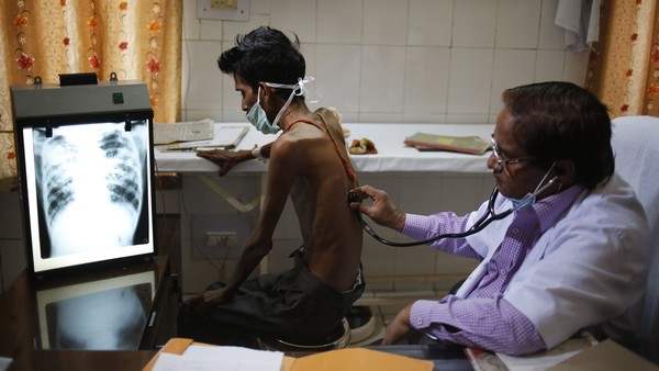 An Indian doctor examines a tuberculosis patient in a government TB hospital on World Tuberculosis Day in Allahabad, India, Monday, March 24, 2014. India has the highest incidence of TB in the world, according to the World Health Organization's Global Tuberculosis Report 2013, with as many as 2.4 million cases. India saw the greatest increase in multidrug-resistant TB between 2011 and 2012. The disease kills about 300,000 people every year in the country. (AP Photo/Rajesh Kumar Singh)